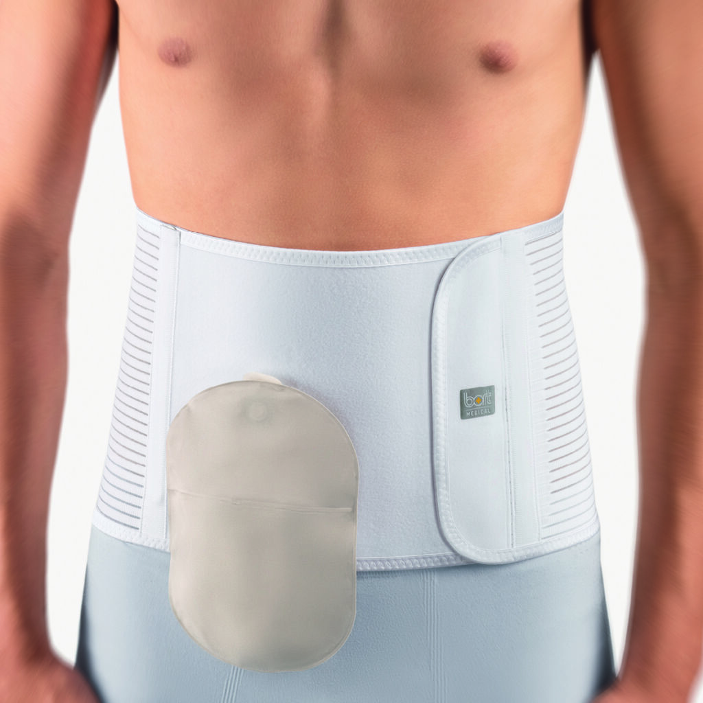Stoma - Brüche an Bauchdecke oder Leiste - OT Baßler