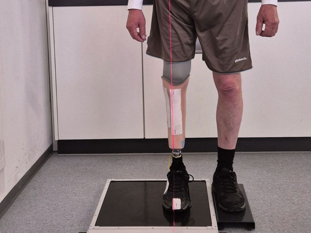 OT Baßler Orthopädie Technik. Ein neuer Schritt beginnt. Erstversorgung nach Unterschenkelamputation